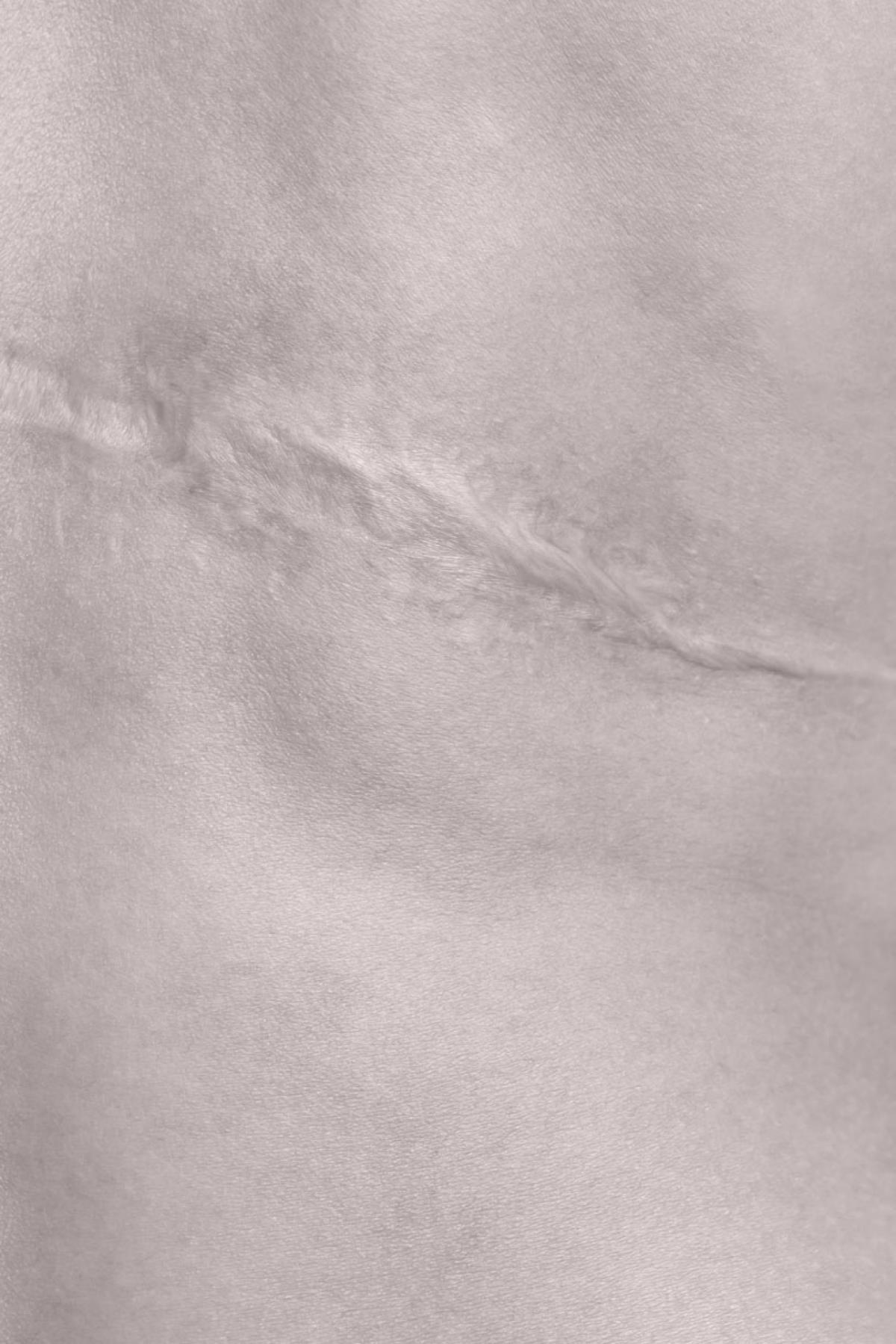 ProDeep - Dr MARIA NORPO - Dermatologie - Esthétique - Chirurgie - BIARRITZ