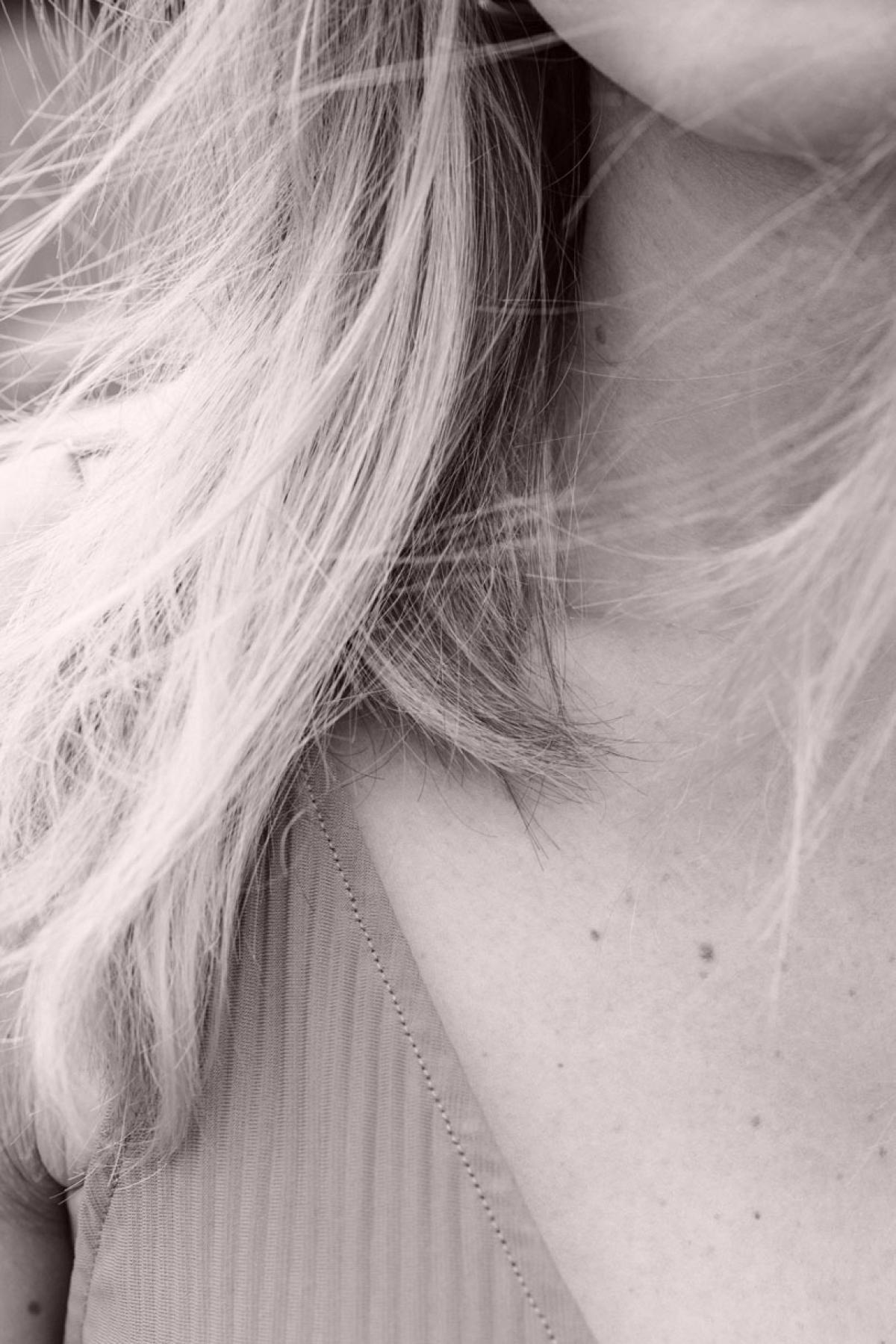 Hair - Dr MARIA NORPO - Dermatologie - Esthétique - Chirurgie - BIARRITZ