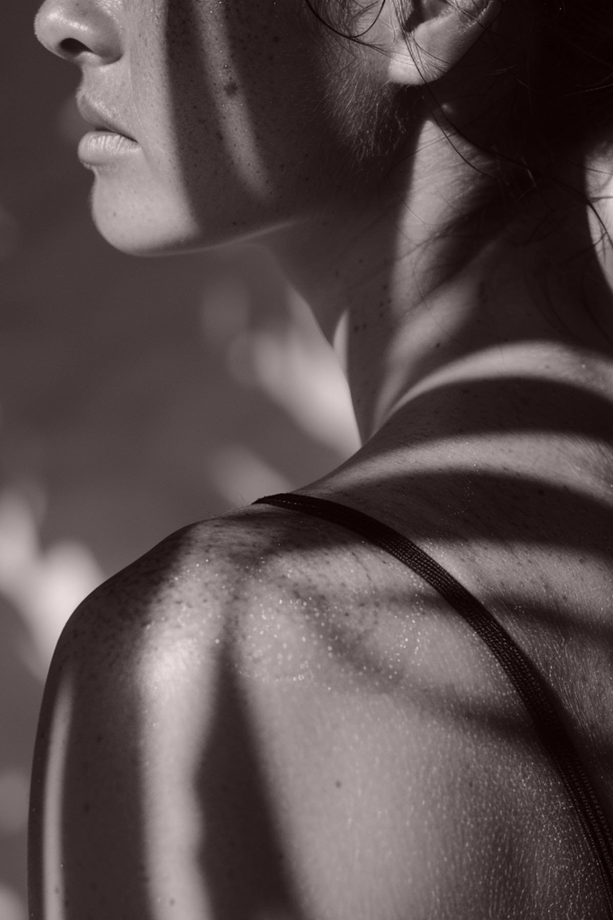 Relâchement cutané - Dr MARIA NORPO - Dermatologie - Esthétique - Chirurgie - BIARRITZ