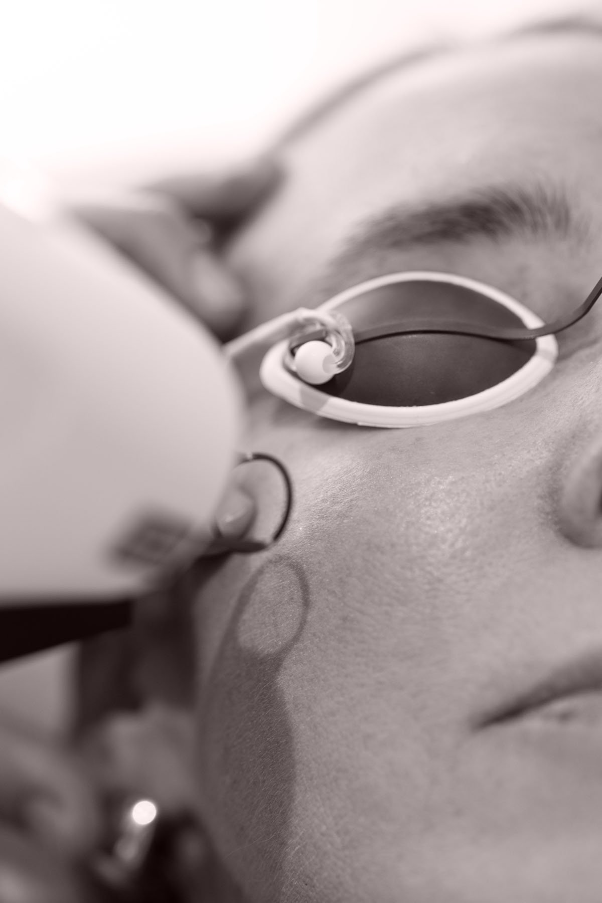 Rougeurs, couperose - Dr MARIA NORPO - Dermatologie - Esthétique - Chirurgie - BIARRITZ