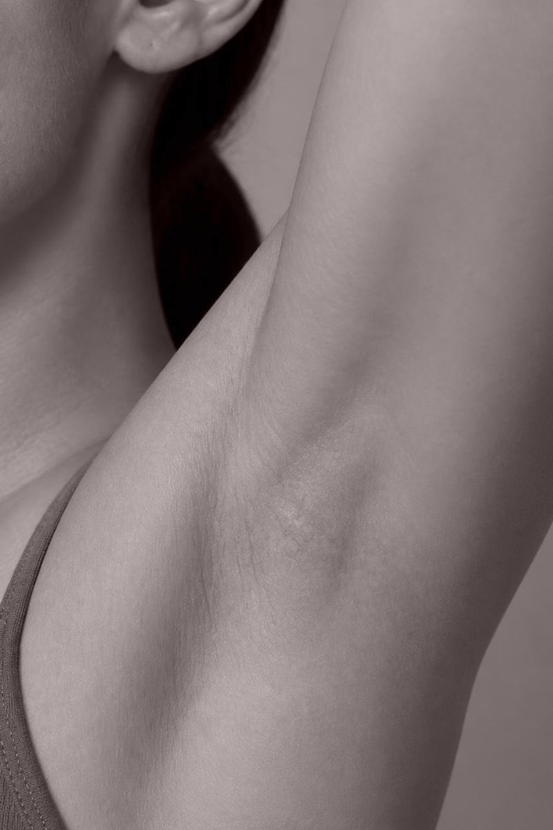 Transpiration excessive - Dr MARIA NORPO - Dermatologie - Esthétique - Chirurgie - BIARRITZ