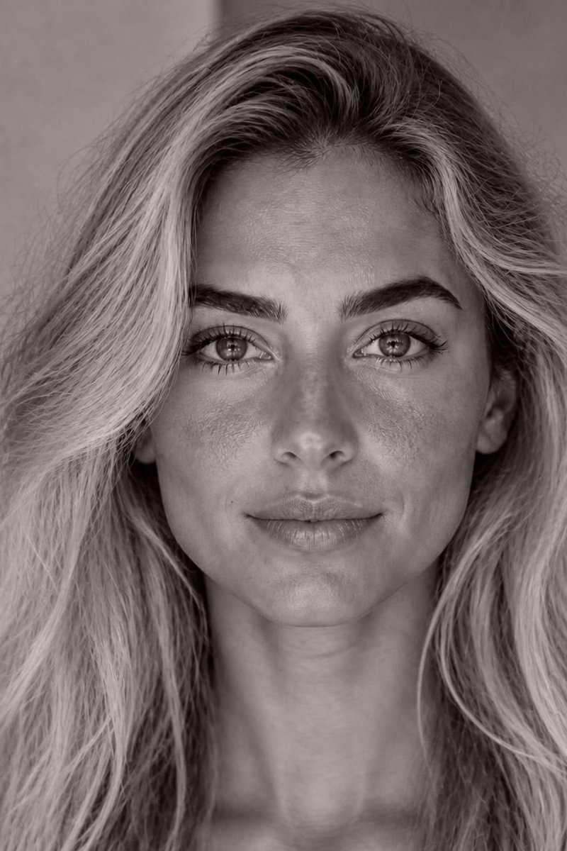 Redness, rosacea - Dr MARIA NORPO - Dermatologie - Esthétique - Chirurgie - BIARRITZ
