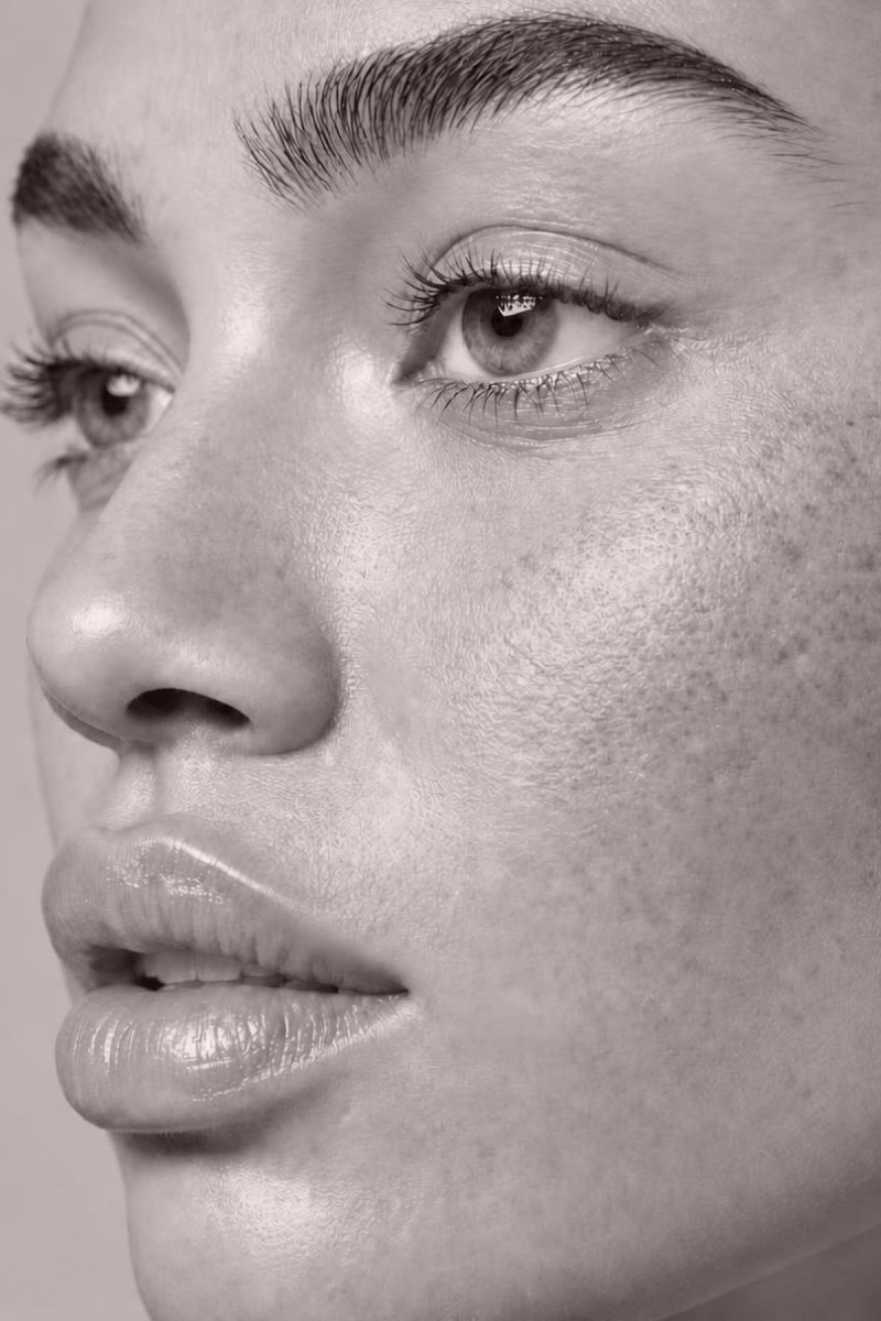Pigmented spots, melasma - Dr MARIA NORPO - Dermatologie - Esthétique - Chirurgie - BIARRITZ