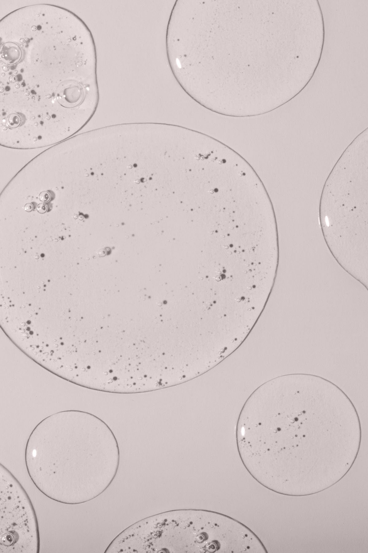 Acne and blemishes - Dr MARIA NORPO - Dermatologie - Esthétique - Chirurgie - BIARRITZ